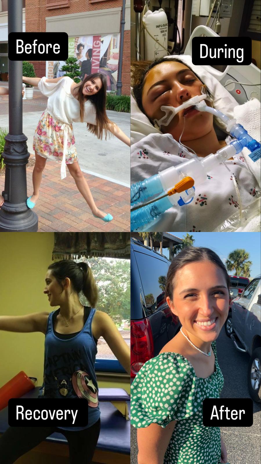 Megan AVM Survivor